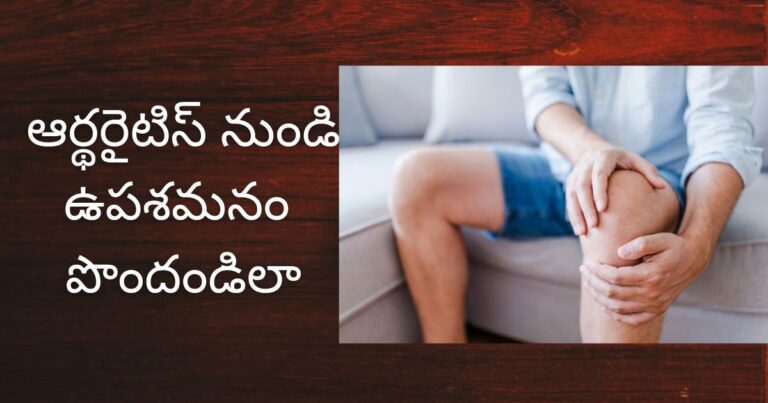 arthritis : ఆర్థరైటిస్ నుండి ఉపశమనం పొందడానికి ఈ 5 మార్పులు చేయండి..!