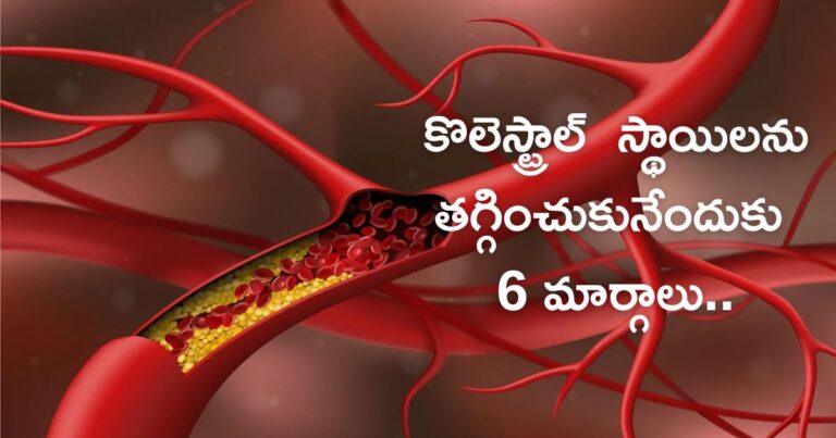 cholesterol : మీ కొలెస్ట్రాల్  స్థాయిలను తగ్గించుకునేందుకు 6 మార్గాలు..