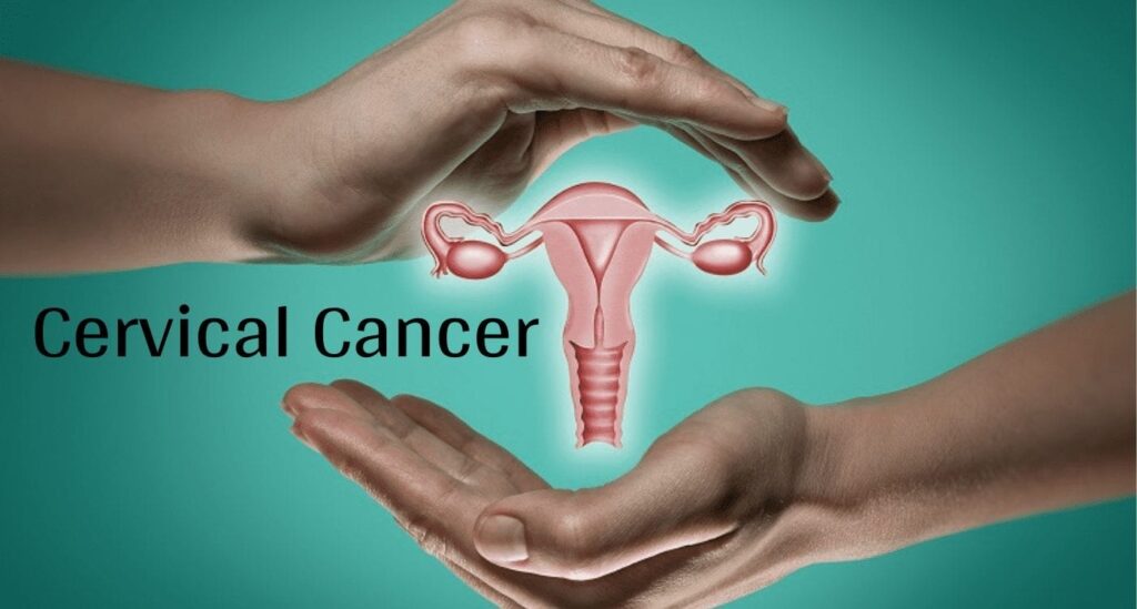 CERVICAL CANCER