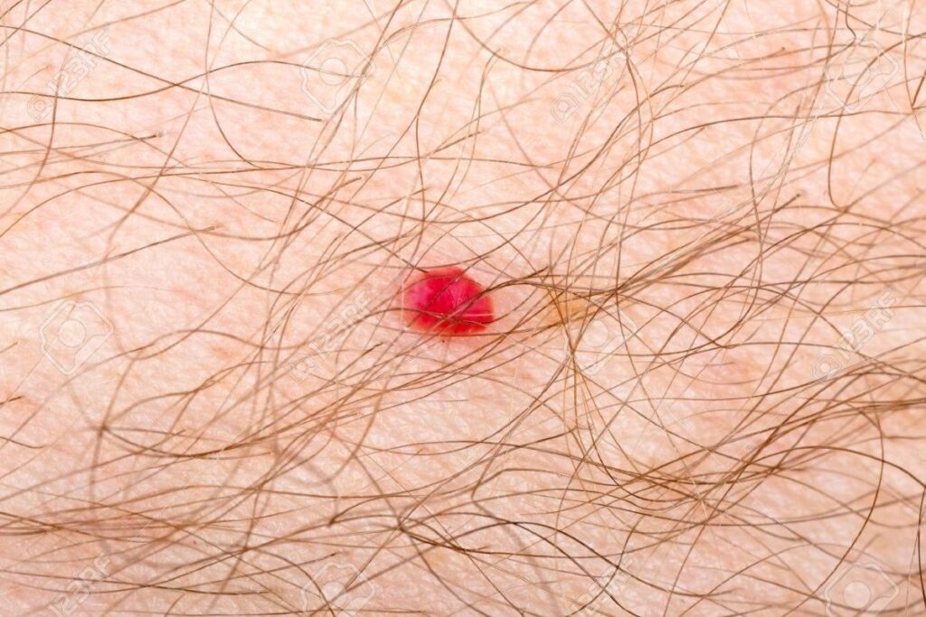 red-dots-on-the-skin-understanding-the-causes-and-concerns